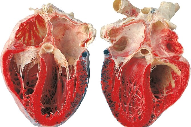 Ticket Expo Body Worlds in Bruges, Belgium - Why the real specimens matter for learning
